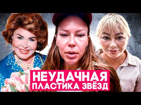 Неудачная пластика звёзд. Дакота, Плющенко, Борисова и другие жертвы пластического хирурга