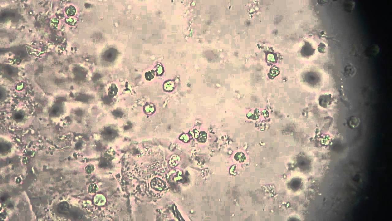 Trichomonas Vaginalis Em Urina Por Microscopia YouTube