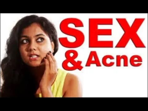 सम्भोग करने से आप कील मुँहासे से छुटकारा पा सकते है │Get Rid of Pimples │Life Care │Health Education