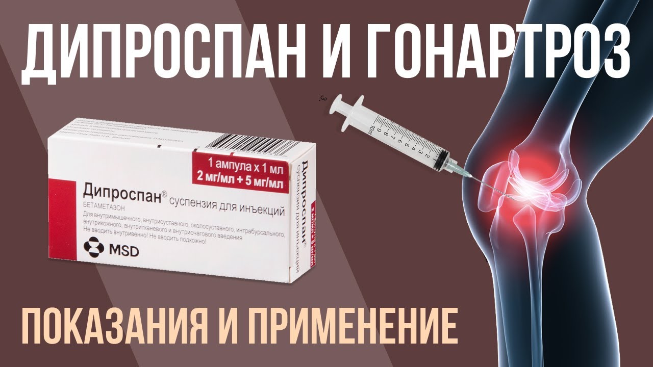 Инъекция От Боли В Суставах Название — Buy-artox.ru