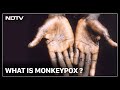 What Is Monkeypox? | Hot Mic with Nidhi Razdan