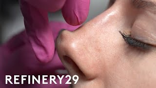 I Tried A Non-Surgical Nose Job | Macro Beauty | Refinery29
