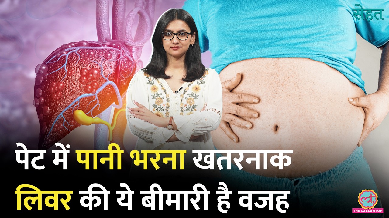 Bloating को हल्के में न लें! पेट में पानी भरा हो सकता है, Ascites Causes & Treatment | Sehat 1395