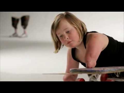 Charlotte: A Life without Limbs'