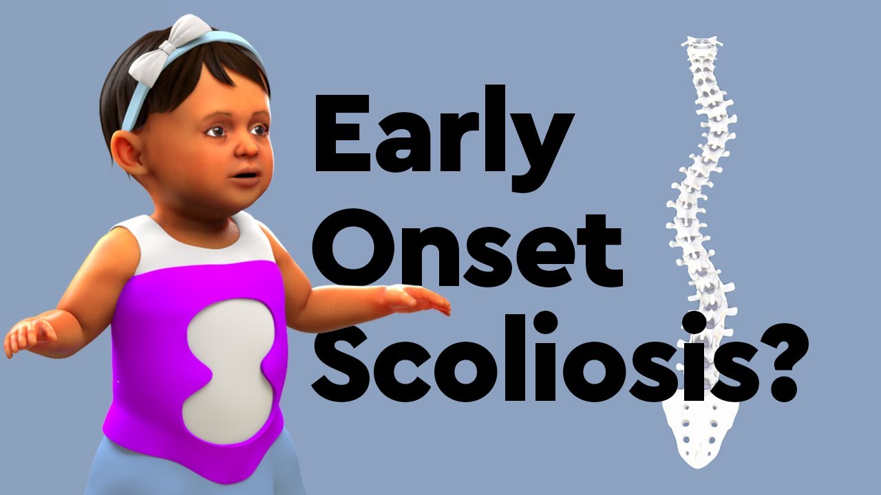 Early Onset Scoliosis  Children's Hospital Colorado