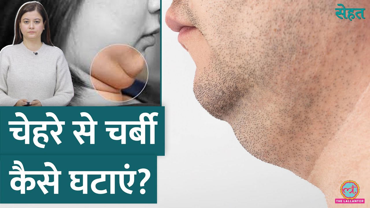 क्या है Buccal Fat Removal जिससे चेहरे पतला लगने लगता है? | Sehat ep 1033