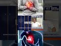 Karnataka Makes Sudden Cardiac Deaths Legally Notifiable Amid Rising Cases | News9
