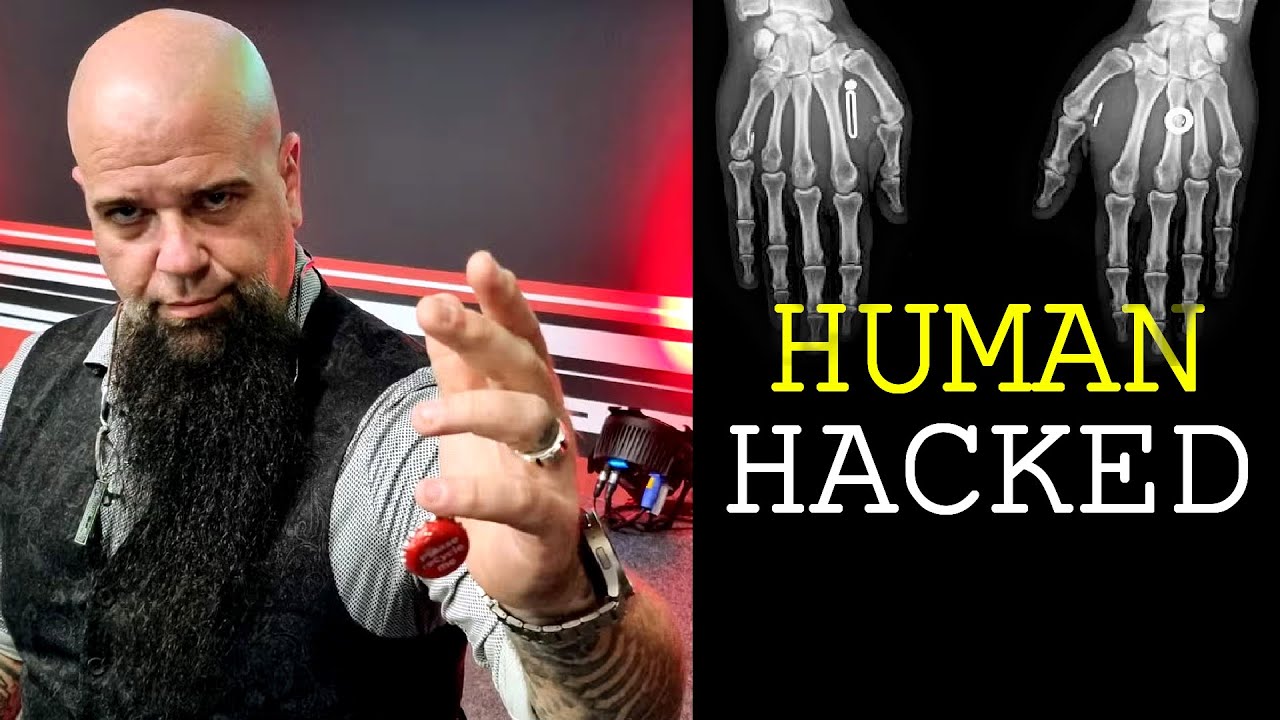 The Hacker with Hardware Implants (interview)