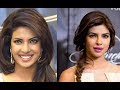 Priyanka Chopra lost out on films because of her plastic surgeries