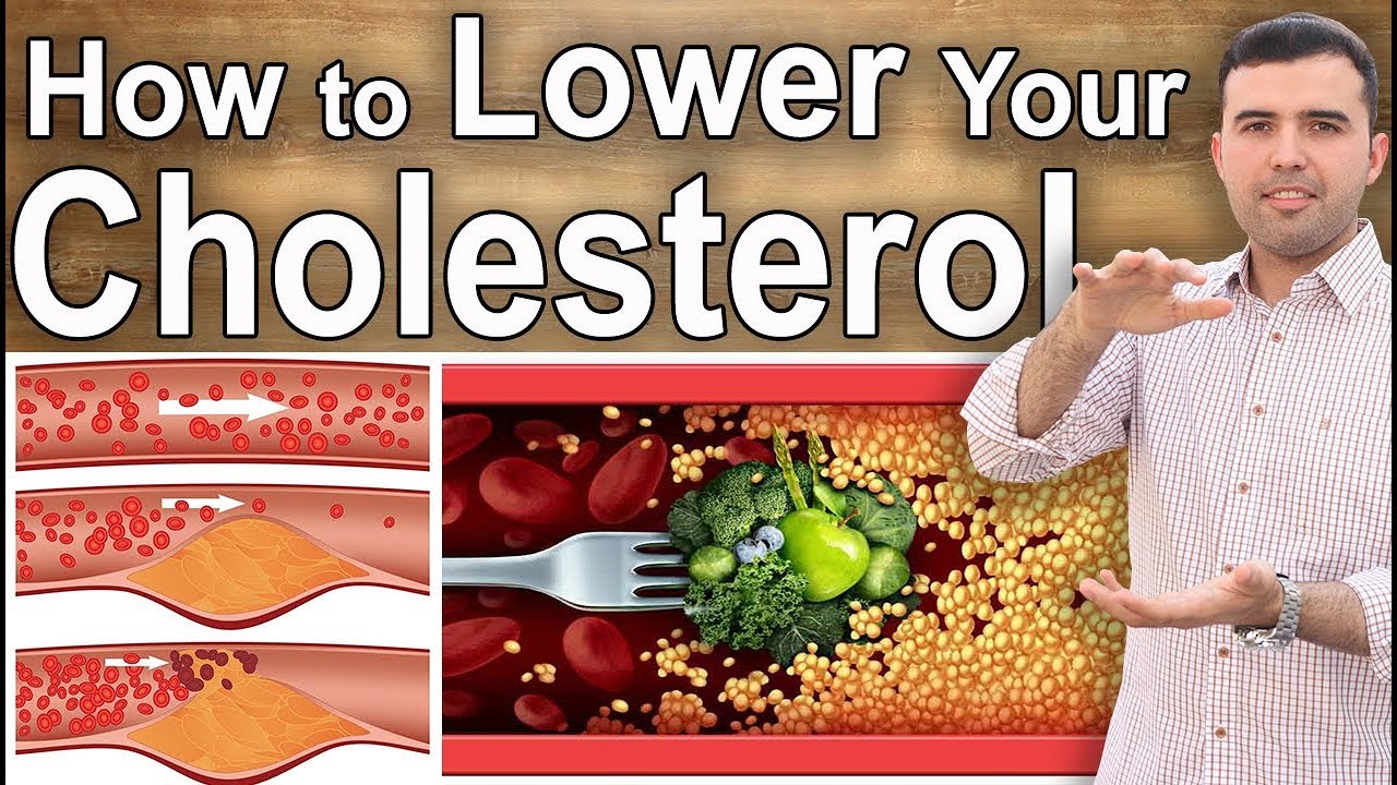 Que ayuda a bajar el colesterol