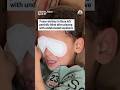 7-year-old boy in Gaza left partially blind after playing with undetonated explosive