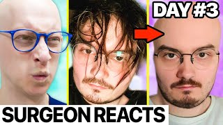 How I Lost ALL My Hair in 3 Days | Surgeon Reacts