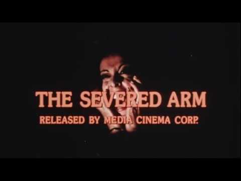 The Severed Arm'