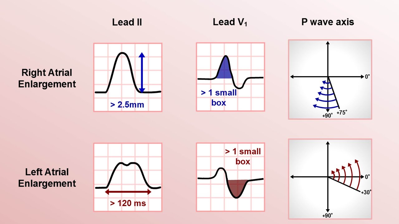 electrocardiography-wikipedia