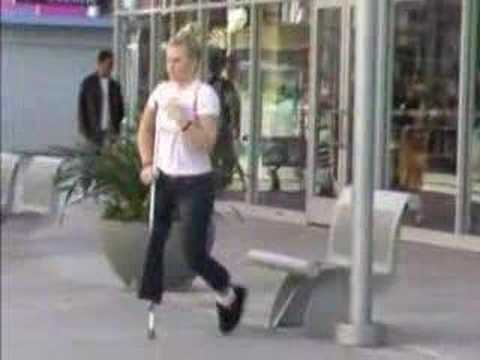 Female Leg Amputee Walking With One Crutch - YouTube