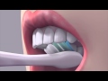 Cum sa-ti cureti dintii