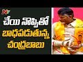 Chandrababu Suffers From Hand Pain