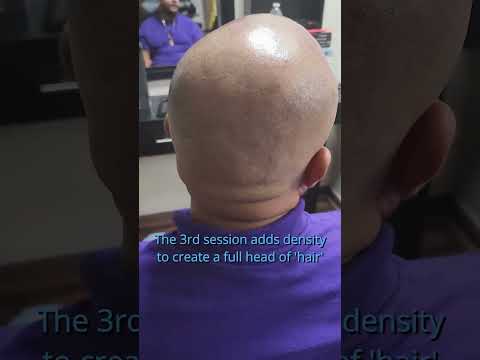 Men's Hair Restoration: Scalp Micropigmentation at The Barbershop 941! #sarasota #smp #pigmentation