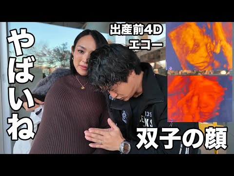 【パパに似てるかも】双子ちゃんの顔を見てきたらビックリ（妊娠23週目）