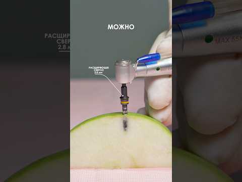 Имплантация с установкой и импозантном за 14.990ru. Подробнее ТГ|WA 8969 00040-40 Инст yourclinic.ru