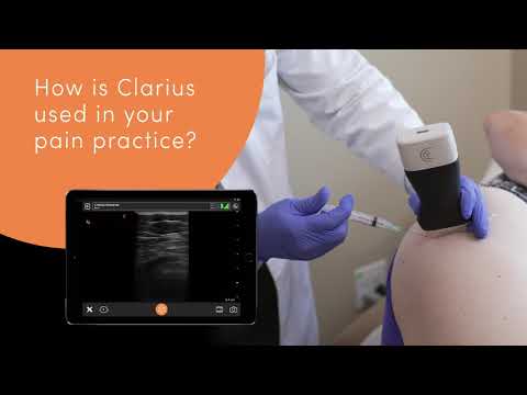 Dr. Rosenblum discusses why handheld ultrasound is the next big thing in pain management