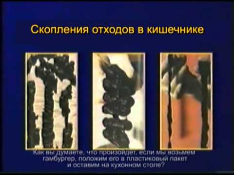 очищение кишечника полисорбом цена очищение кишечника полисорбом цена