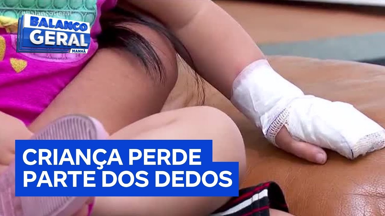 Criança perde parte dos dedos em creche na zona leste de São Paulo