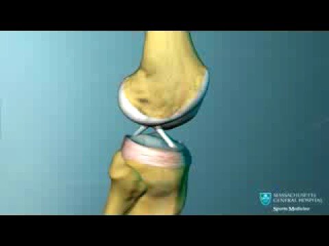 RODILLA Y SUS LIGAMENTOS - YouTube diagram of normal knee 