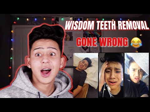 REACTING TO MY WISDOM TEETH VIDEOS | ALEX GUZMAN