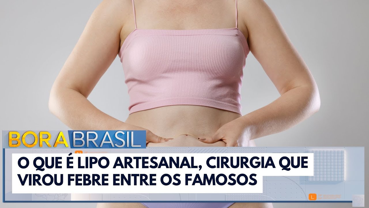 O que é lipo artesanal cirurgia que virou febre entre os famosos