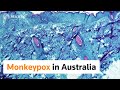 Australia reports first confirmed case of monkeypox