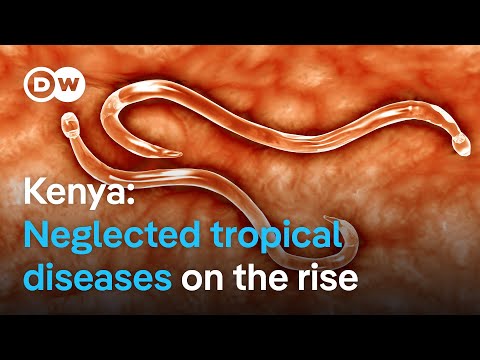 Floods in Kenya trigger outbreaks of neglected tropical diseases like intestinal worms | DW News