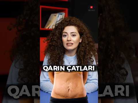 Hamiləlikdə Qarın Çatlarının Qarşısını Alan 5 Məsləhət #birbax #sağlamlıq #hamilə #hamile #hamiləlik