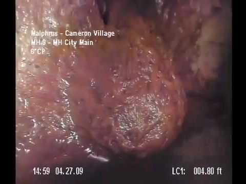 Unknown Lifeform in Sewer revealed ! 下水道不知名生物現形