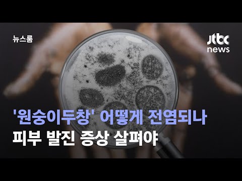 '원숭이두창' 어떻게 전염되나…피부 발진 증상 살펴야 / JTBC 뉴스룸