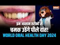 World Oral Health Day : मोती की तरह चमक उठेंगे आपके Yellow Teeth, अपना लें यह आसान तरीका