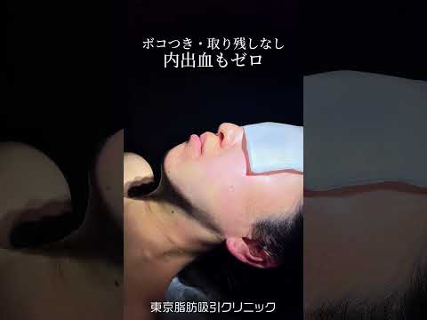 【インフルエンサーはみんなやってるかも！】#美容整形 #脂肪吸引 #美容