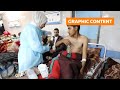 GRAPHIC WARNING: Survivors describe Gaza aid chaos as inquiry pressure mounts on Israel | REUTERS