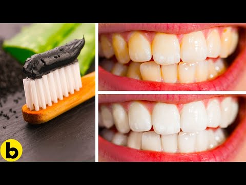 Како можете да ги избелите вашите заби без скапи третмани?