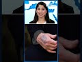 Trump News | Donald Trumps Mysterious Hand Mark: Just A Bruise Or Something Bigger?  - 02:11 min - News - Video