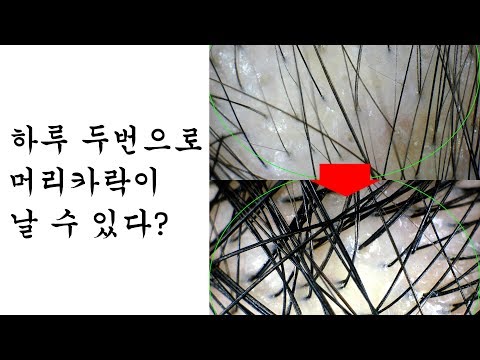 미녹시딜에 대해 알아봅시다 !