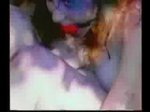 The Mutilation Man'