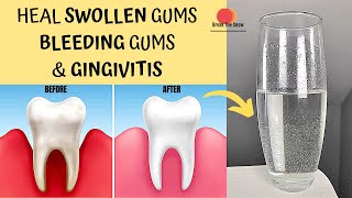 20 secs ✅ KEEP GUMS AND TEETH HAPPY | GINGIVITIS, RECEDING GUMS AND SWOLLEN GUMS TREATMENT