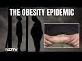 Obesity | Over A Billion People Are Obese Worldwide, Says Lancet Study
