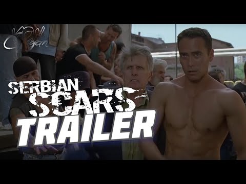 Serbian Scars'