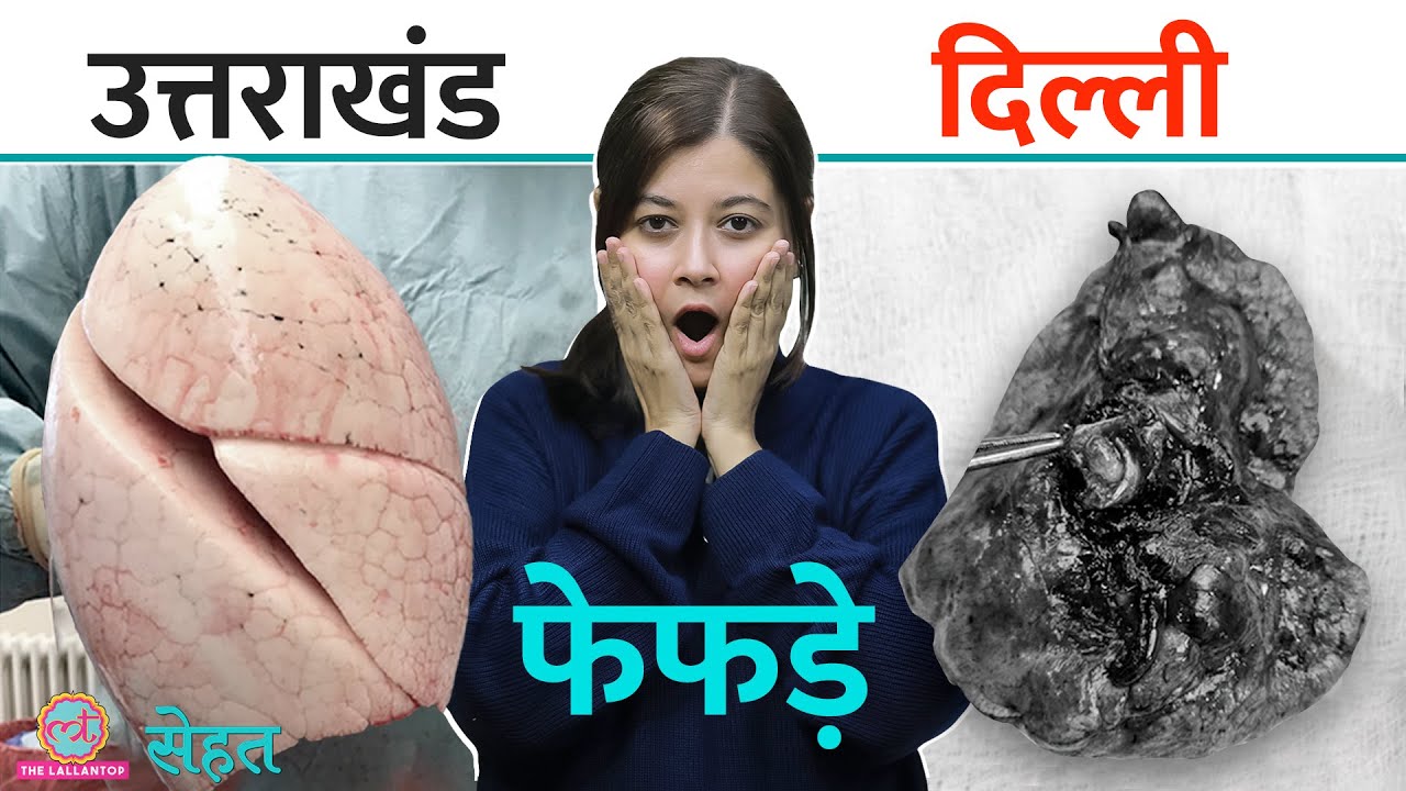 बिना सिगरेट पिए हो गया Cancer, Delhi-Uttarakhand के फेफड़े में ये अंतर! | Sehat ep 1023