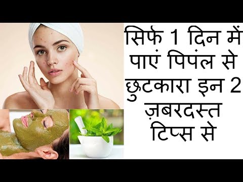 सिर्फ 1 दिन में पाएं पिपंल से छुटकारा इन 2 ज़बरदस्त टिप्स से.!!