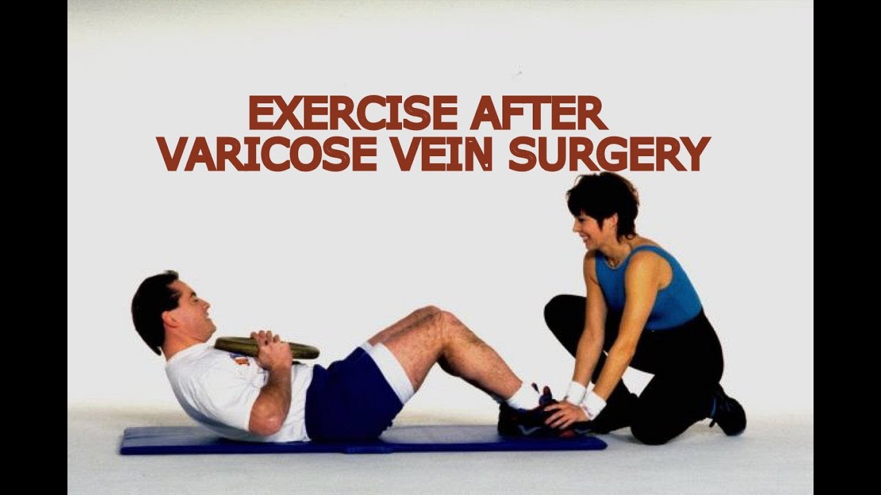 Exercise After Varicose Vein Surgery What is the Best ...