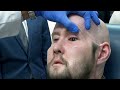Man receives world’s first eye transplant after high-voltage electrical accident