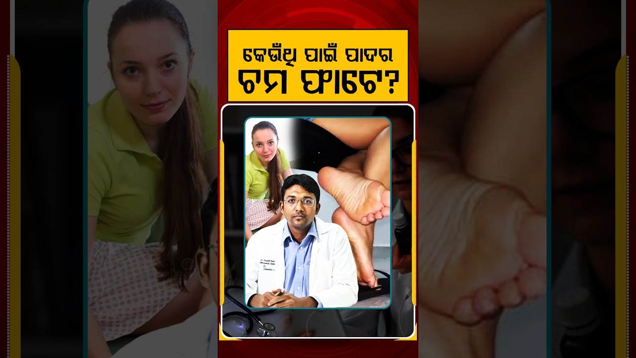 କେଉଁଥି ପାଇଁ ପାଦର ଚମ ଫାଟେ ? | Prescription | Argus Reels | Cracked Heels | FootCareTips | HealthTips